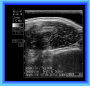 setter_angus037008.jpg